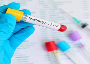 স্পেনে প্রথমবারের মতো মারবার্গ রোগ শনাক্ত